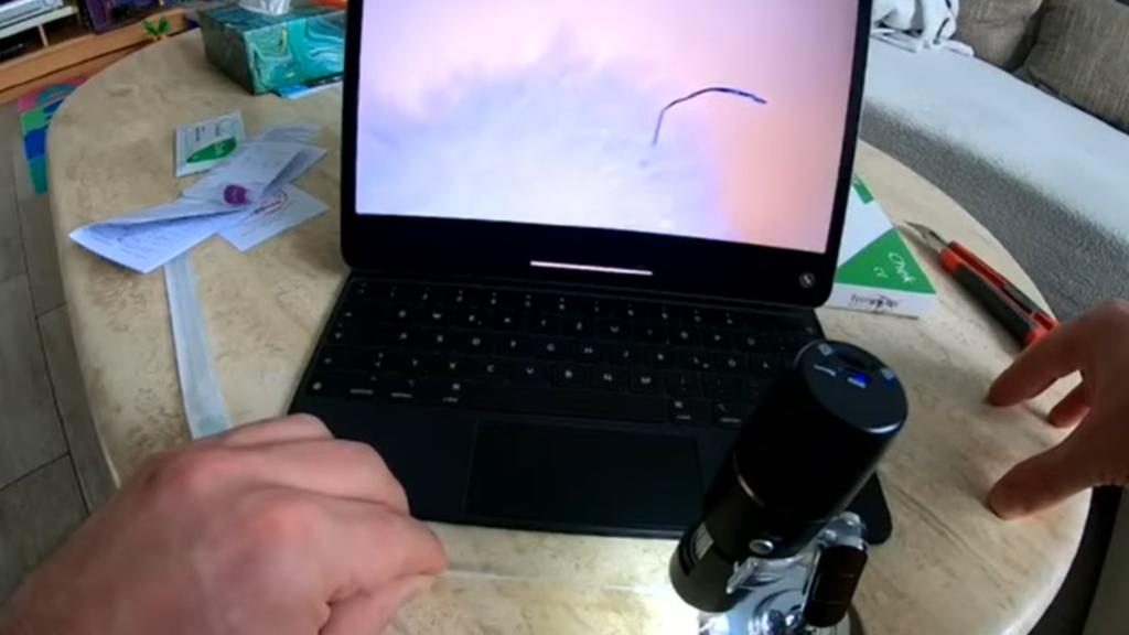 Unheimliche Entdeckung der dritten Art? Videos zeigen angebliche Beweise für Würmer und Parasiten in Testtupfern von Corona-Schnelltest-Kits,