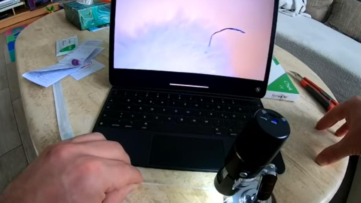 Unheimliche Entdeckung der dritten Art? Videos zeigen angebliche Beweise für Würmer und Parasiten in Testtupfern von Corona-Schnelltest-Kits,