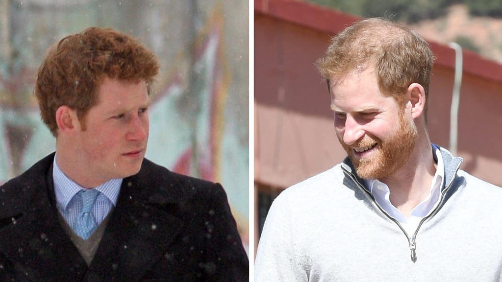 Prinz Harrys Frisur im Wandel der Zeit