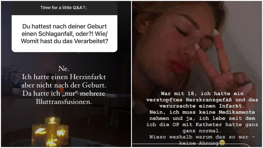 Samantha Abdul spricht über einen gesundheitlichen Schicksalsschlag in ihrer Jugend.