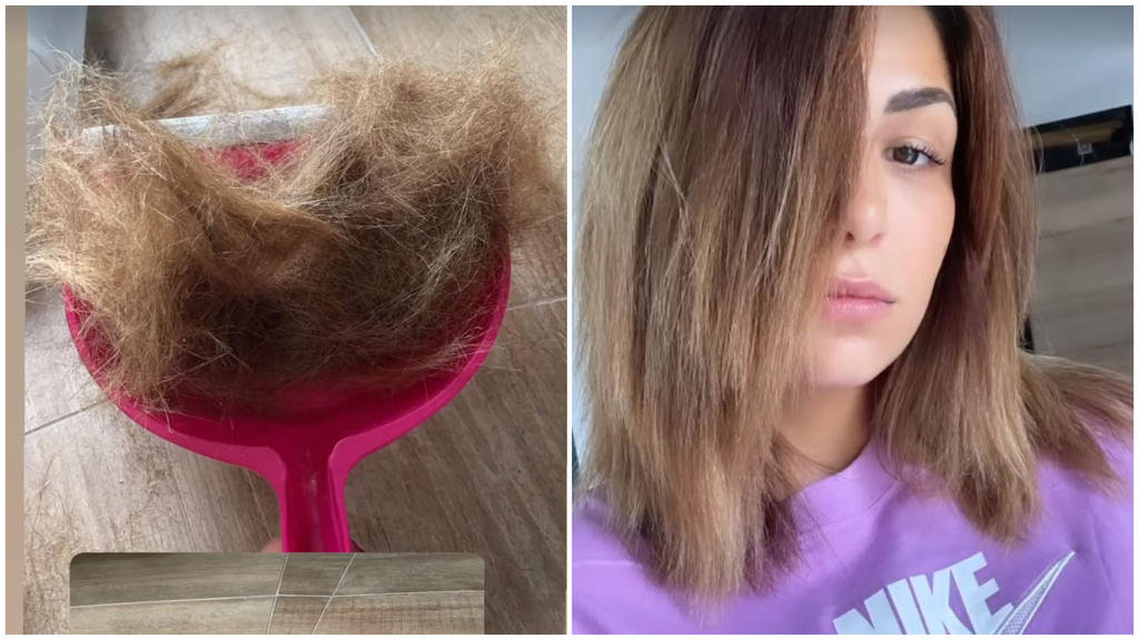 Inci musste nach einer misslungenen Keratin-Behandlung ganz schön Haare lassen.