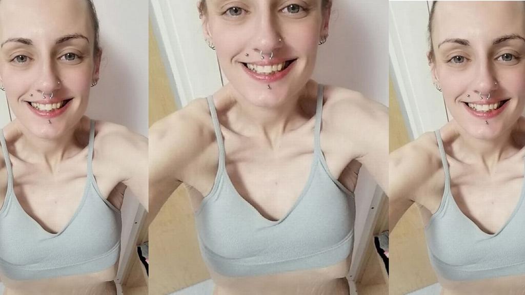 Man sieht eine stark untergewichtige Frau, dessen Rippen herauskommen.