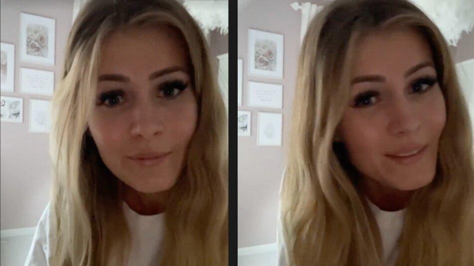Hanna gesteht, dass sie kein Geheimnis aus ihrem misslungenen Beauty-Eingriff machen wollte.