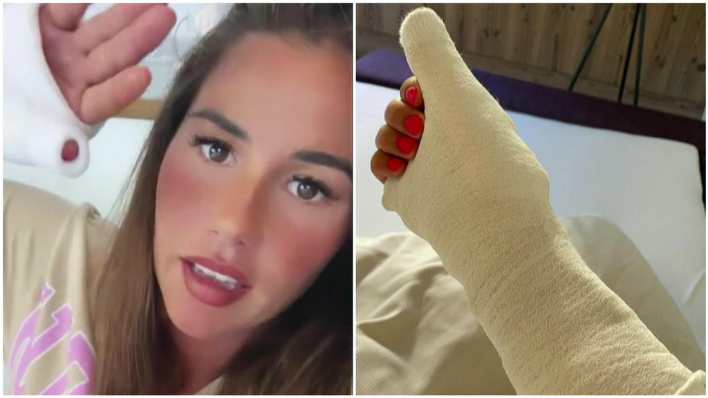 Sarah Engels hat sich die Hand gebrochen: Den Gips zeigt sie in einer Insta-Story
