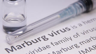 Das Marburg-Virus hat in Westafrika einen Toten gefordert..