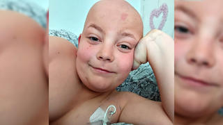 Der 10-jährige David Lally bekam Ende Dezember 2020 die Diagnose Multipler Hirntumor.