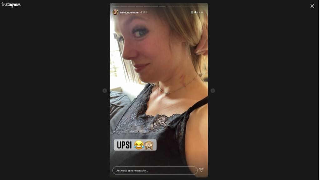 Anne Wünsche entdeckt Knutschfleck in Insta-Story