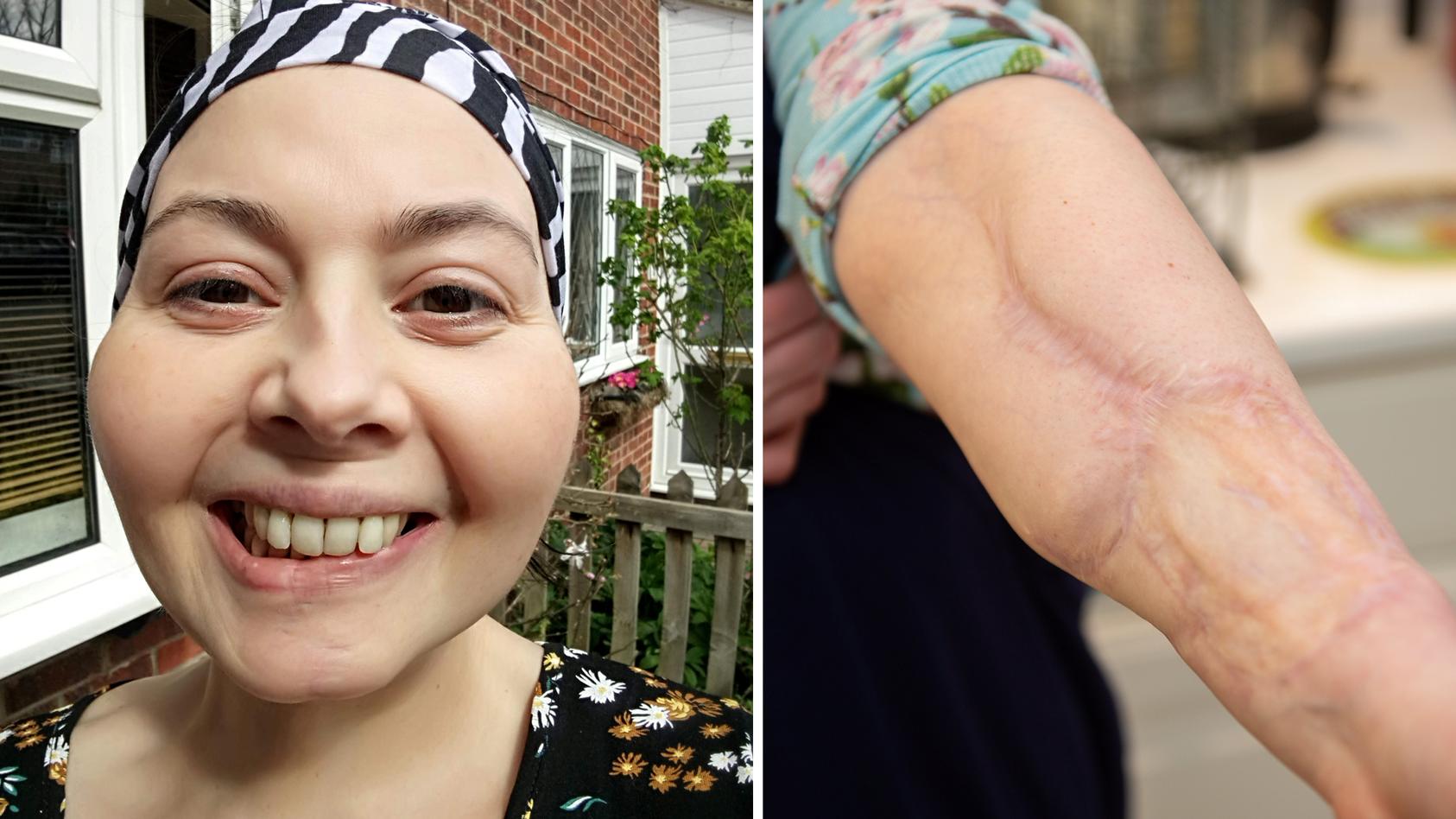 Krebspatientin Laura Marston wurde die Zunge entfernt. Trotzdem kann sie wieder schmecken.