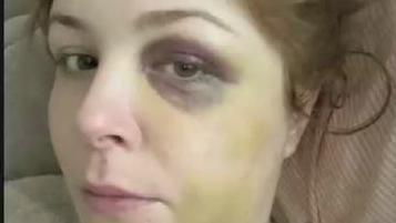Mit ihrer Geschichte will Sarah anderen Frauen Mut machen, Gewaltdelikte anzuzeigen und sich Hilfe zu holen.
