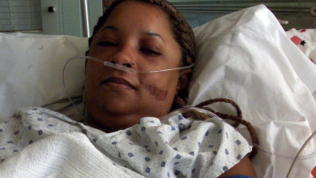 Genelle Guzman, 32, of Brooklyn, N.Y., recuperates from Tuesday's terrorist attack on the World Trade Center, in Bellevue Hospital Center in New York, Friday, Sept. 14, 2001. Guzman was on the 64th floor when the attack occurred. She made it to the 1