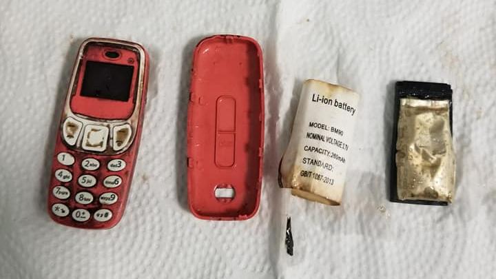 Knacki verschluckt Nokia 3310 - Arzt veröffentlicht Fotos nach der OP