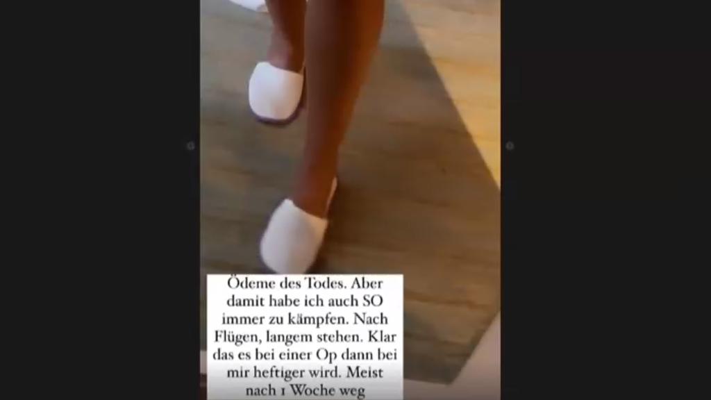 "Ödeme des Todes" - Die Youtuberin gewährt einen Blick auf ihre Wasserablagerungen.