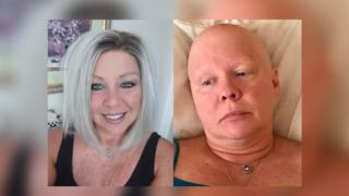 Tamara Dougherty fielen nach einer Brust-OP auf einmal die Haare aus.