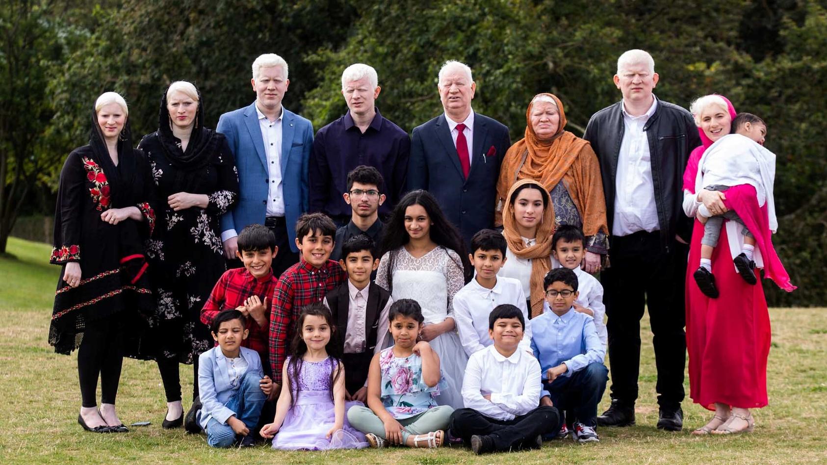 Die Parvez' sind die wohl größte Albino-Familie weltweit.