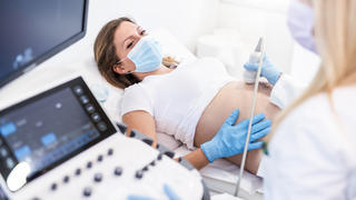 Welches Risiko besteht, dass eine Corona-Infektion bei Schwangeren zu Komplikationen führt?