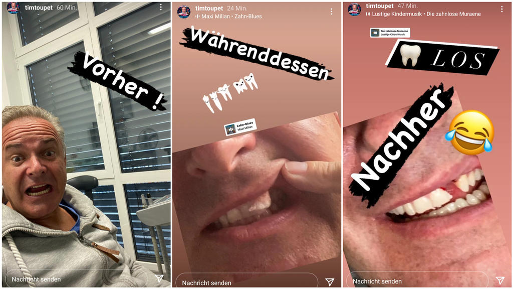 Tim Toupet: Vorher und nachher beim Zahnarzt