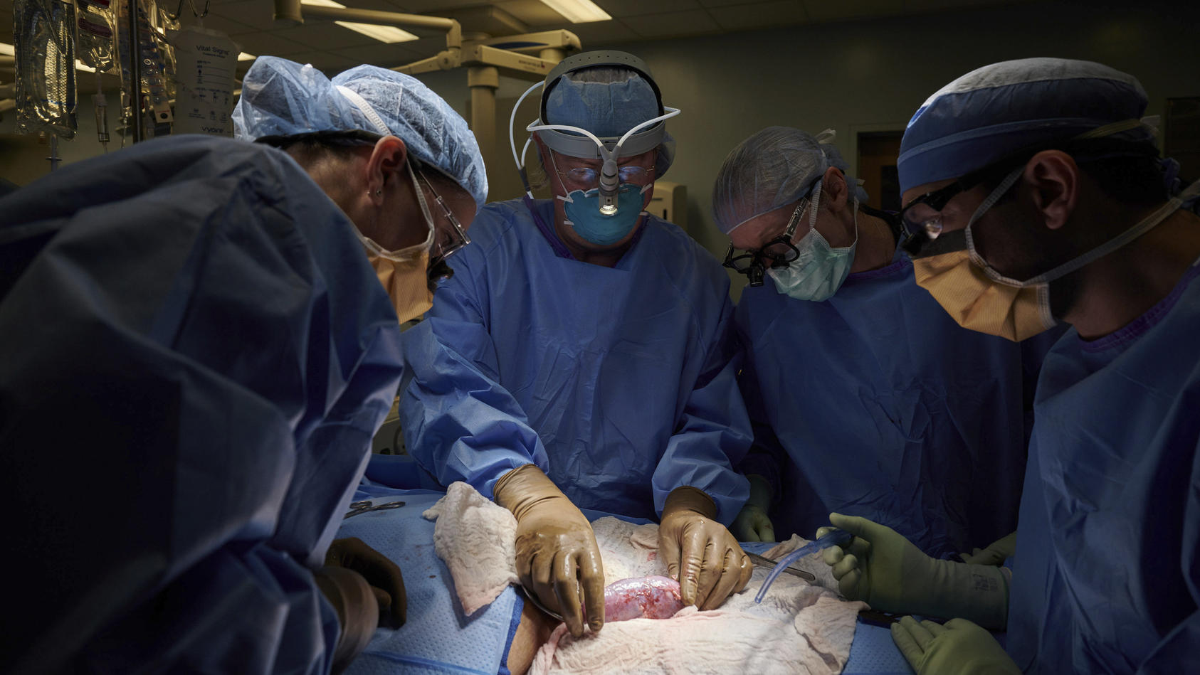 HANDOUT - 25.09.2021, USA, New York: Auf diesem Foto vom September 2021, das von NYU Langone Health zur Verfügung gestellt wurde, untersucht ein Chirurgenteam in einem Krankenhaus eine Schweineniere, die am Körper eines Verstorbenen befestigt ist, au