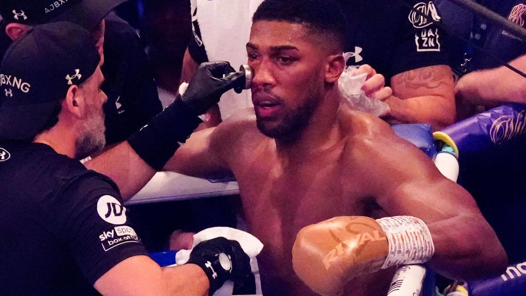  Mandatory Credit: Photo by Dave Shopland/Shutterstock 12463389at Anthony Joshua v Oleksandr Usyk - Joshua gets treatment on the swelling around his right eye Anthony Joshua vs. Oleksandr Usyk & Undercard, Boxing, Tottenham Hotspur Stadium, London, U
