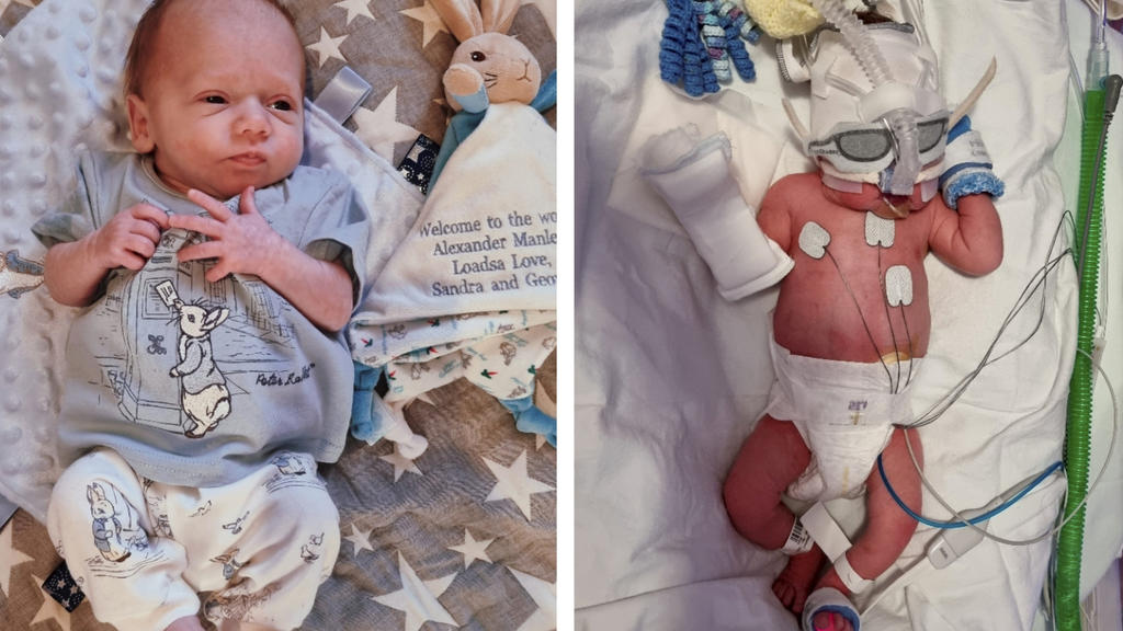 Baby Alexander musste wiederbelebt werden