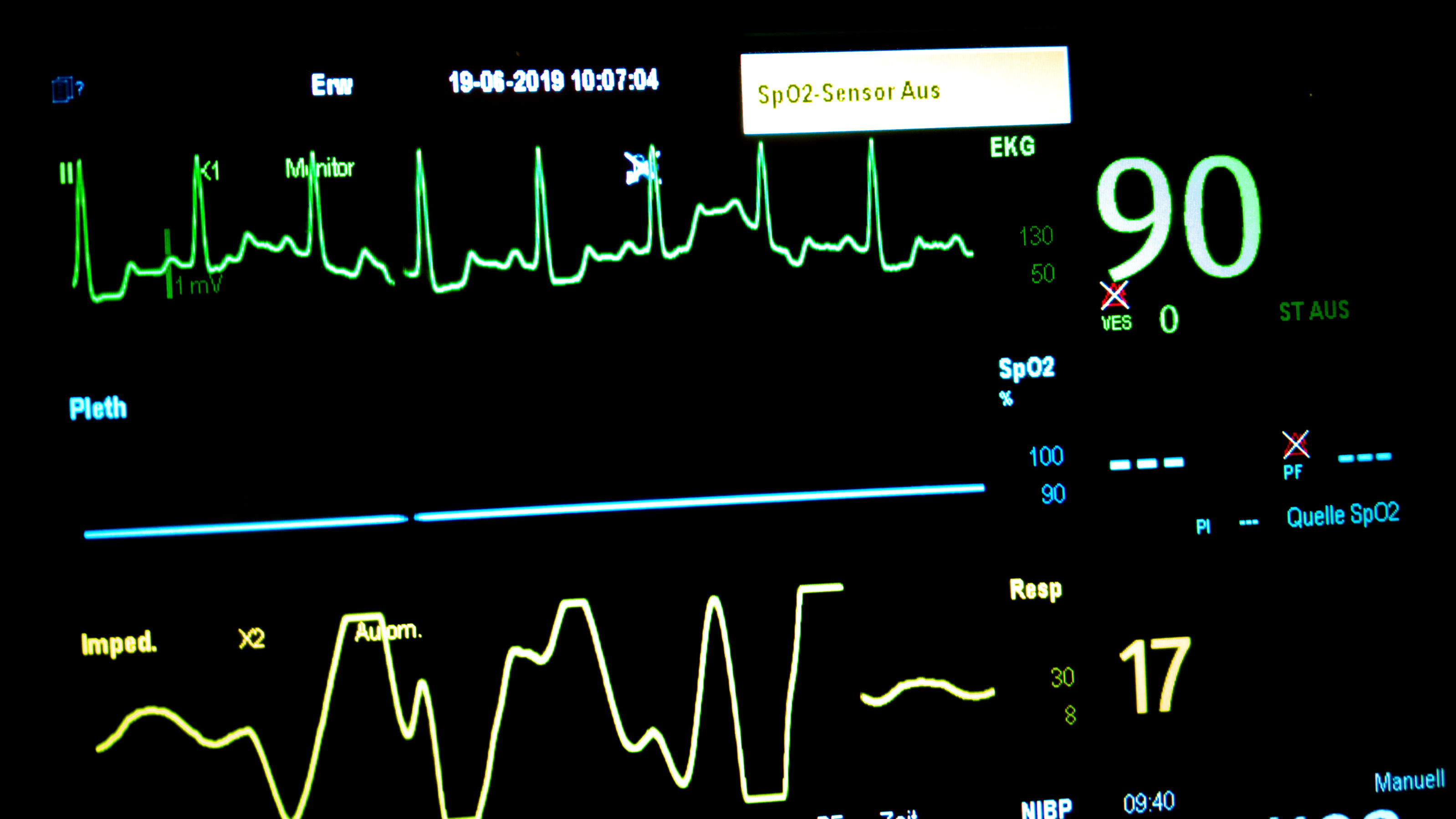 Ein EKG schreibt die Herzfrequenz eines Patienten.