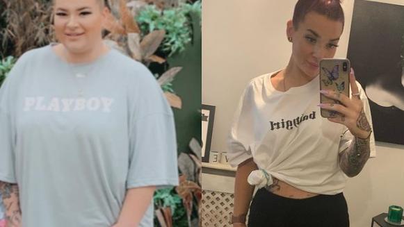 Links: Kayleigh vorher, rechts: Kayleigh nachher. Sie hat sich einem "Mommy Makeover" unterzogen.