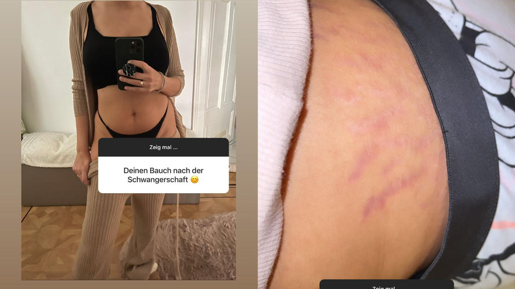 Yeliz Koc zeigt ihren After-Baby-Body bei Instagram.