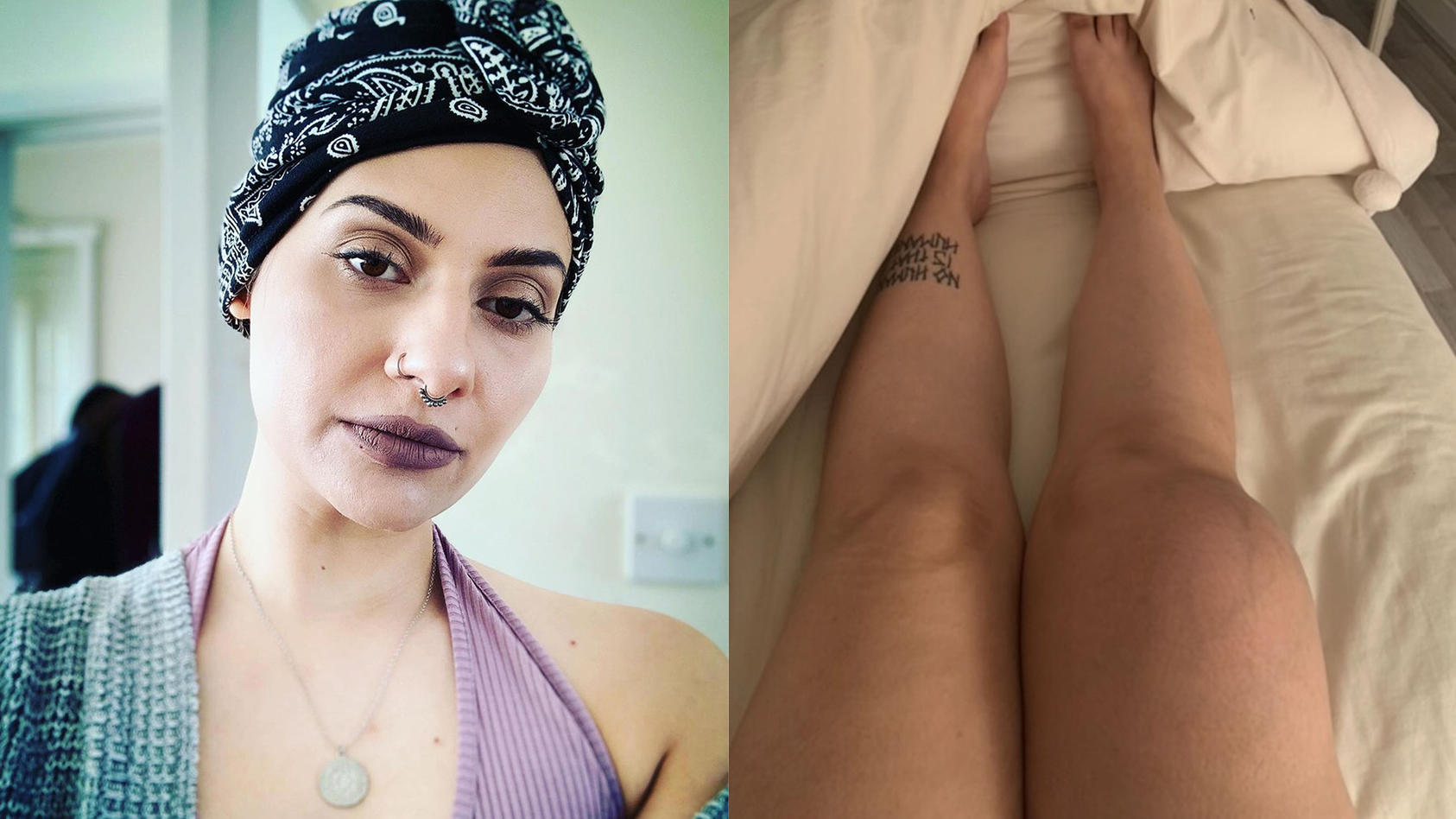 Joanna macht ein Selfie mit einem Turban auf dem Kopf und man sieht das angeschwollene Knie.