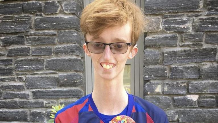 Bereits als kleines Kind entwickelte der heute 18-jährige Dylan Lombard aus Glasgow erste Anzeichen einer Krankheit, die bisher weltweit nur 13 Mal diagnostiziert wurde: das MDPL-Syndrom.
