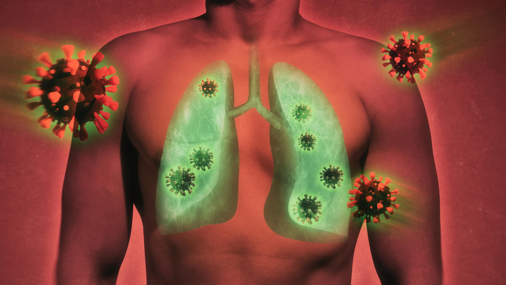Eine Covid-19-Erkrankung kann die Lunge schwer schädigen.