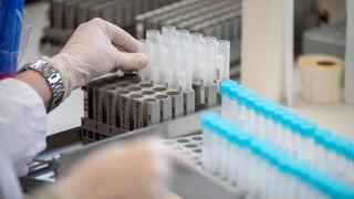 PCR-Test