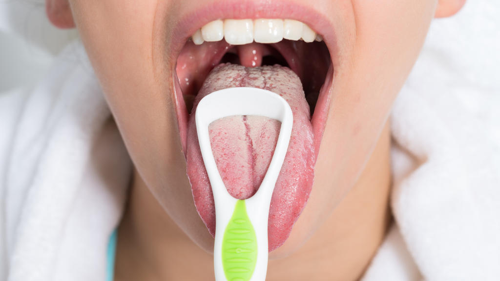 Weißlicher Zungenbelag kann nach der Traditionellen Chinesischen Medizin eine Erkrankung sein.