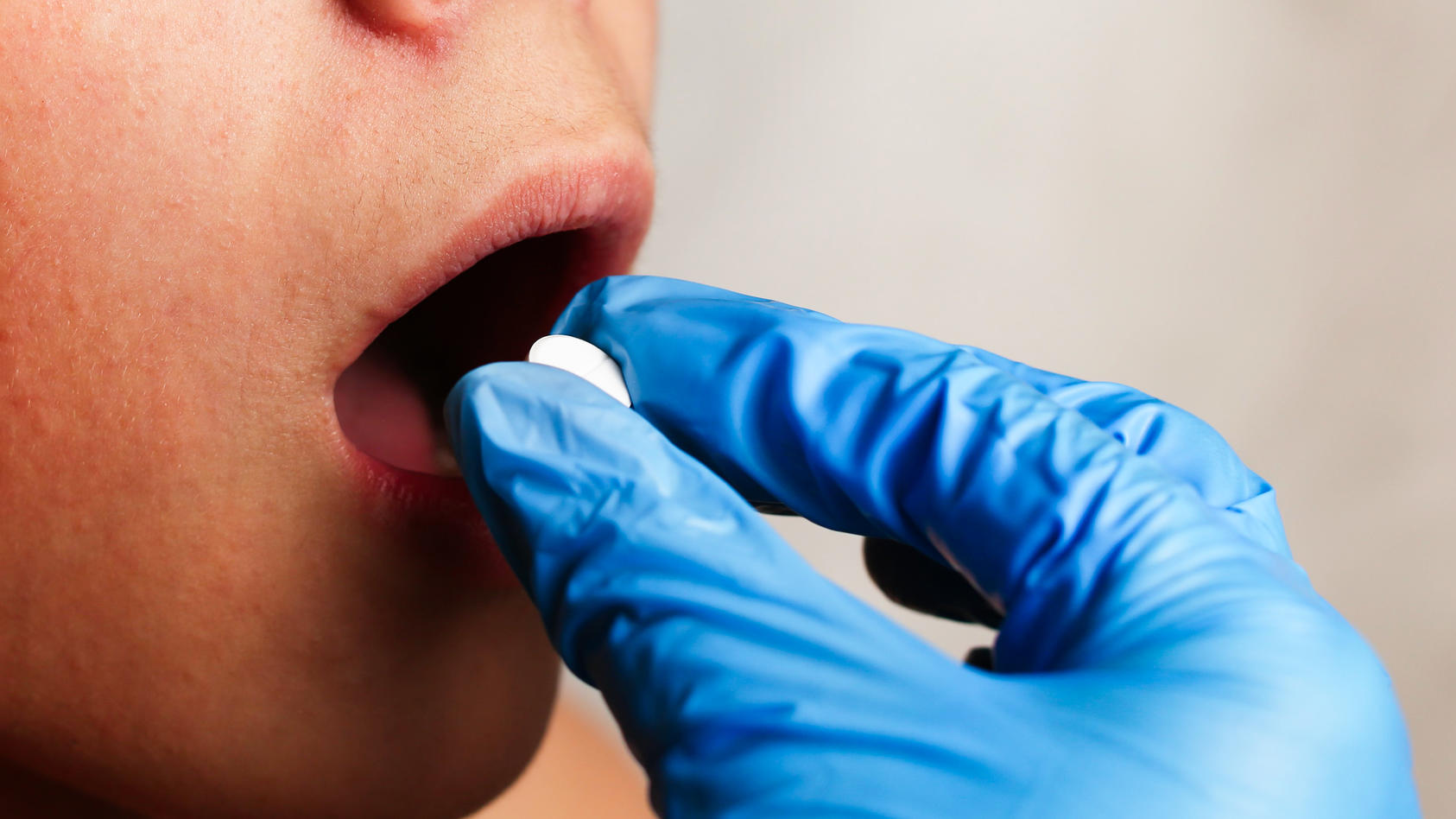 Arzt legt Tablette in Mund eines Patienten