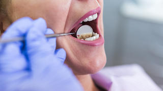 Frau wird beim Zahnarzt untersucht