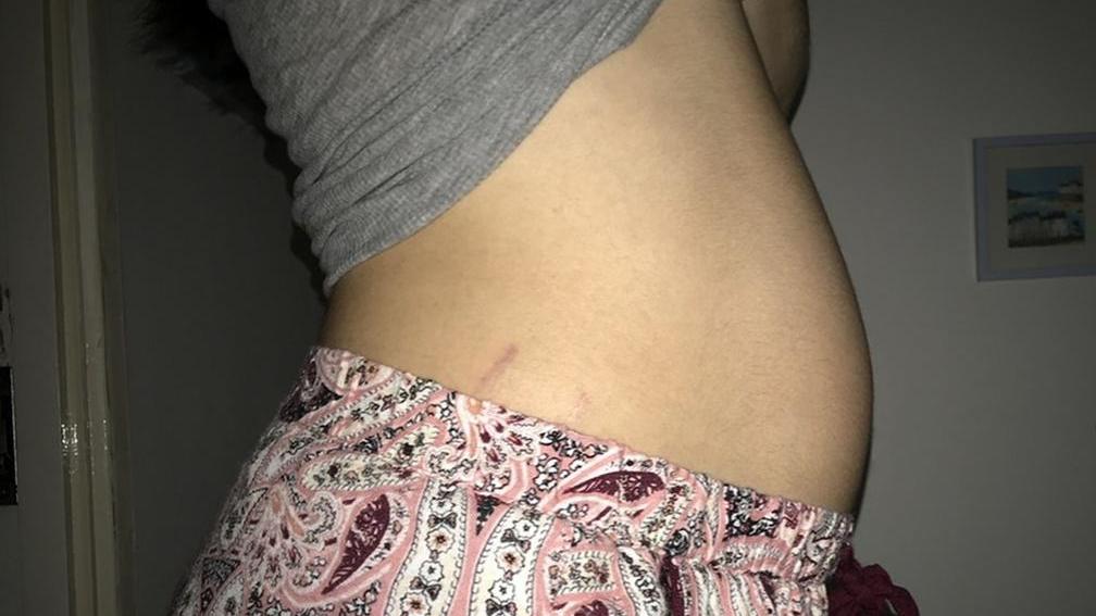 Ellie Johnson während ihrer unbemerkten Schwangerschaft