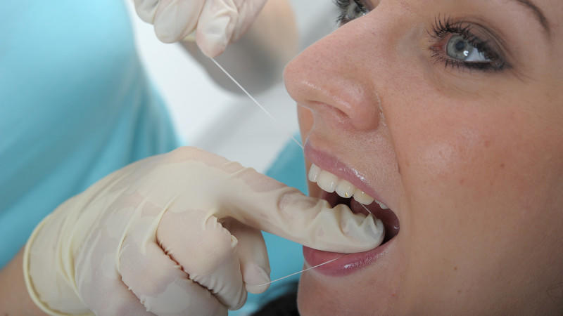 Zahnmedizinische Prophylaxe: Schutzmaßnahmen vor möglichen Erkrankungen der Zähne, des Zahnfleisches und des Kiefers