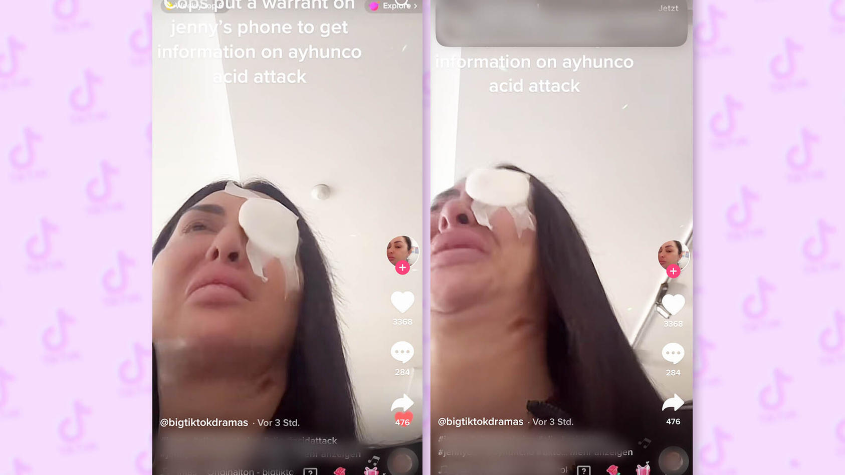 Säureangriff während Livestream Brutale Attacke auf TiktokStar