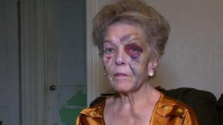 Shirlene Hernandez (72) wird überfallen und verprügelt. Der Täter klaut das Auto der Großmutter - und stirbt wenig später.