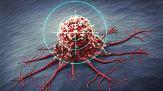 3D Rendering einer Krebszelle - medizinische Illustration