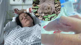 Verletzter Finger, Frau und Katze auf einem Bild