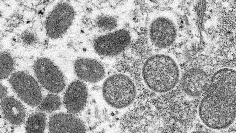 diese-elektronenmikroskopische-aufnahme-zeigt-reife-ovale-affenpockenviren-l-und-kugelformige-unreife-virionen-r-die-aus-einer-menschlichen-hautprobe-stammt-foto-cynthia-s-goldsmithrussell-regnercdcapdpa