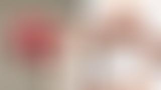 Baby Ayla mit horizontaler Gesichtsspalte