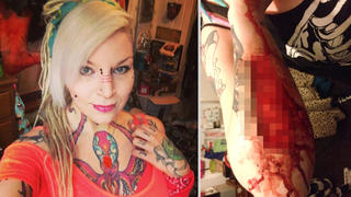 Torz Reynolds mit blutigem Arm, aus dem ihr Liebestattoo geschnitten wurde