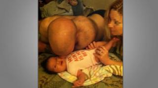 Optische Täuschung: Vater küsst Baby, es sieht jedoch so aus, als halte er seinen Hintern ins Bild.