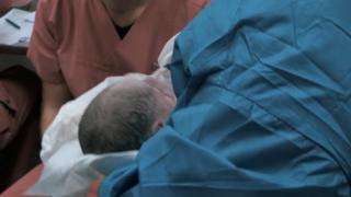 brasilien-baby-verletzt-nach-sturzgeburt-am-krankenhaus-niemand-half-der-mutter
