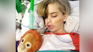 Archie mit Schläuchen im Krankenbett