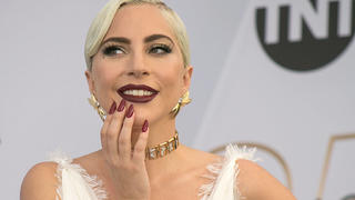  February 26, 2021, Los Angeles, California, USA: Lady Gaga offers $500,000 for return of dogs after thief steals them and shoots dog walker identified as Ryan Fischer. FILE PHOTO: Lady Gaga at the red carpet of the 25th Annual Screen Actors Guild Awards held at the Shrine Auditorium in Los Angeles, California, Sunday January 27, 2019. /PI Los Angeles USA - ZUMAp124 20210226_zaa_p124_006 Copyright: xJAVIERxROJASx