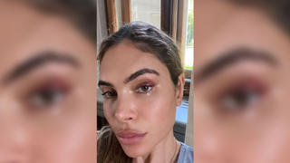 Ayda Field zeigt sich auf Instagram mit blauem Auge - was ist passiert?