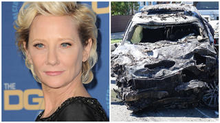 Schauspieler Anne Heche erlitt bei einem Autounfall schwere Verbrennungen.