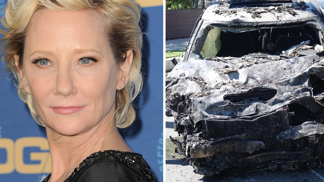 Schauspieler Anne Heche hatte einen schweren Autounfall.