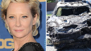 Schauspieler Anne Heche erlitt bei einem Autounfall schwere Verbrennungen.